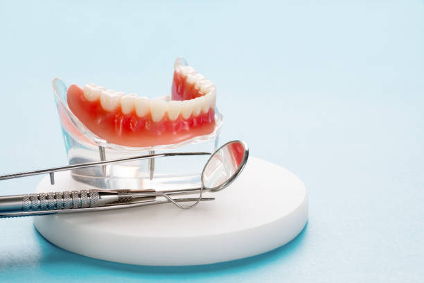 Full Mouth Reconstruction in La Plata, MD